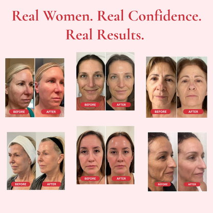 VENEXA™ Time Reverse Cream (All-In-One)